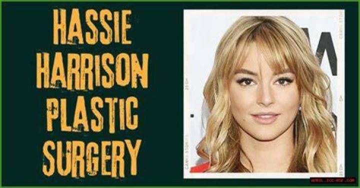 Uncover The Truth Behind Hassie Harrison's Plastic Surgery Journey